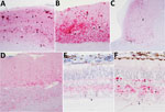 Thumbnail of Immunohistochemical analysis for the prion protein showing scrapie prion protein (PrPSc) deposits in brains (A–D) and retinas (E, F) from reindeer (Rangifer tarandus tarandus) with chronic wasting disease. PrPSc immunodetection using the monoclonal antibody F99/97.6.1. A) Neocortex, prominent aggregated and plaque-like deposits in reindeer no. 4. Original magnification ×5. B) Cerebellum, particulate immunoreactivity and aggregated deposits in reindeer no. 4. Note absence of intraneu