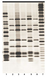 Thumbnail of IS6110 Southern blot hybridization patterns of 6 Mycobacterium tuberculosis isolates recovered from elephants A (lanes 1–5) and C (lane 6) (4) in study of tuberculosis in captive elephants, Albuquerque, New Mexico, USA, 1997–2013. The fingerprint pattern in lane 1 types the strain to principal genetic group 1, the fingerprint pattern in lanes 2–4 and lane 6 types the strain to principal genetic group 2 and the fingerprint pattern in lane 5 types the strain to principal genetic group