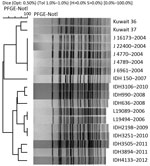 Thumbnail of Comparison of PFGE patterns of NotI-digested chromosomes of Vibrio cholerae O1 isolates from Kuwait with those of isolates obtained from various years (indicated by last 4 digits) from Kolkata, India. The digested chromosomes were separated on CHEF MAPPER (Bio-Rad, Hercules, CA, USA) and dendrogram constructed and analyzed by Bionumerics software (Applied Maths, Sint-Martens-Latem, Belgium). PFGE, pulsed-field gel electrophoresis.