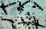 Thumbnail of Infected tissues from 6 bottlenose dolphins (Tursiops truncatus) with paracoccidioidomycosis ceti, Indian River Lagoon, Florida, USA, showing typical branching chains of yeast-like cells of Paracoccidioides brasiliensis connected by small isthmuses. A) Strain FB-921; B) FB-938; C) FB-946; D) FB-952; E) B92-932; F) SW070458. Gomori’s methenamine silver stained. Scale bars indicate 10 µm.