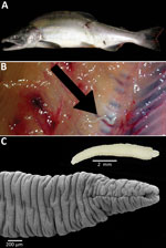 Thumbnail of A) Pink salmon (Oncorhynchus gorbuscha) from Alaska, USA. B) Plerocercoid of Japanese broad tapeworm (Diphyllobothrium nihonkaiense) (arrow) deep in the muscles of the salmon. C) Live D. nihonka plerocercoid in saline (inset) and scanning electron micrograph after fixation with hot water; note the scolex with a long, slit-like bothrium opened anteriorly.
