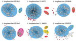 Thumbnail of Legionella longbeachae plasmid analysis: contigs networks reconstructions for 6 representative L. longbeachae types of plasmid content. The networks of the contigs representing the main chromosome and plasmids comprising the genome obtained by using PLACNET (38), a program enabling reconstruction of plasmids from whole-genome sequence datasets. The sizes of the contig nodes (in gray) are proportional to their lengths; continuous lines correspond to scaffold links. Dashed lines repre