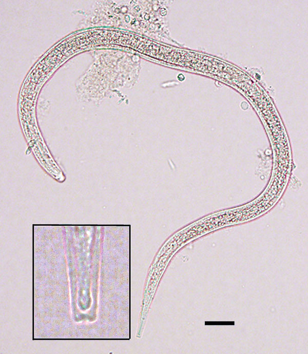 Size and shape of a Dracunculus medinensis third-stage larva recovered from a Phrynobatrachus francisci frog from Chad. Scale bar indicates 25 μm. Inset shows detailed morphology of the tip of the tail of the larva, including the characteristic 3-lobed tip.