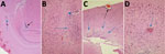 Thumbnail of Photomicrographs of Fitzroy River virus (FRV)–induced meningoencephalitis in weanling mice inoculated with 1,000 infectious units of FRV. Panels show multifocal mild to severe perivascular and neuropil infiltration of lymphocytes and monocytes (blue arrows in A–C); meningitis in a sulcus (black arrow in A); glial cell activation with notable astrocytosis, neuron degeneration, and neuronophagia (arrowhead in B); occasional hemorrhage (blue arrow in D); mild periventricular spongiosis
