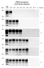Thumbnail of Western blots of variant Creutzfeldt-Jakob disease (vJCD) proteinase K–resistant prions (PrPres) analyzed by protein misfolding cyclic amplification (PMCA) in tissues of clinical and asymptomatic patients. PMCAs were seeded with a 10-fold serial dilutions of a reference vCJD brain homogenate (10% wt/vol, 10−2–10−10 dilutions). This homogenate had been endpoint titrated by bioassay in bovine prion (PrP)–expressing mice (tgBov, intracerebral route, 107.7 50% lethal dose/g). PMCA subst