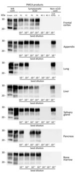 Thumbnail of Western blots of proteinase K–resistant prions (PrPres) in PMCA reactions seeded with peripheral tissues. PMCA reactions were seeded with a 10-fold dilution series (10−2–10−9) of variant Creutzfeldt-Jakob disease (vCJD) tissue homogenates that had been collected postmortem from vCJD patients during the clinical stage (symptomatic vCJD patient 1–vCJD patient 4 [P1–P4]) or at an asymptomatic or preclinical stage of the disease (vCJD asymp) (Table 2). Reactions seeded with tissues from