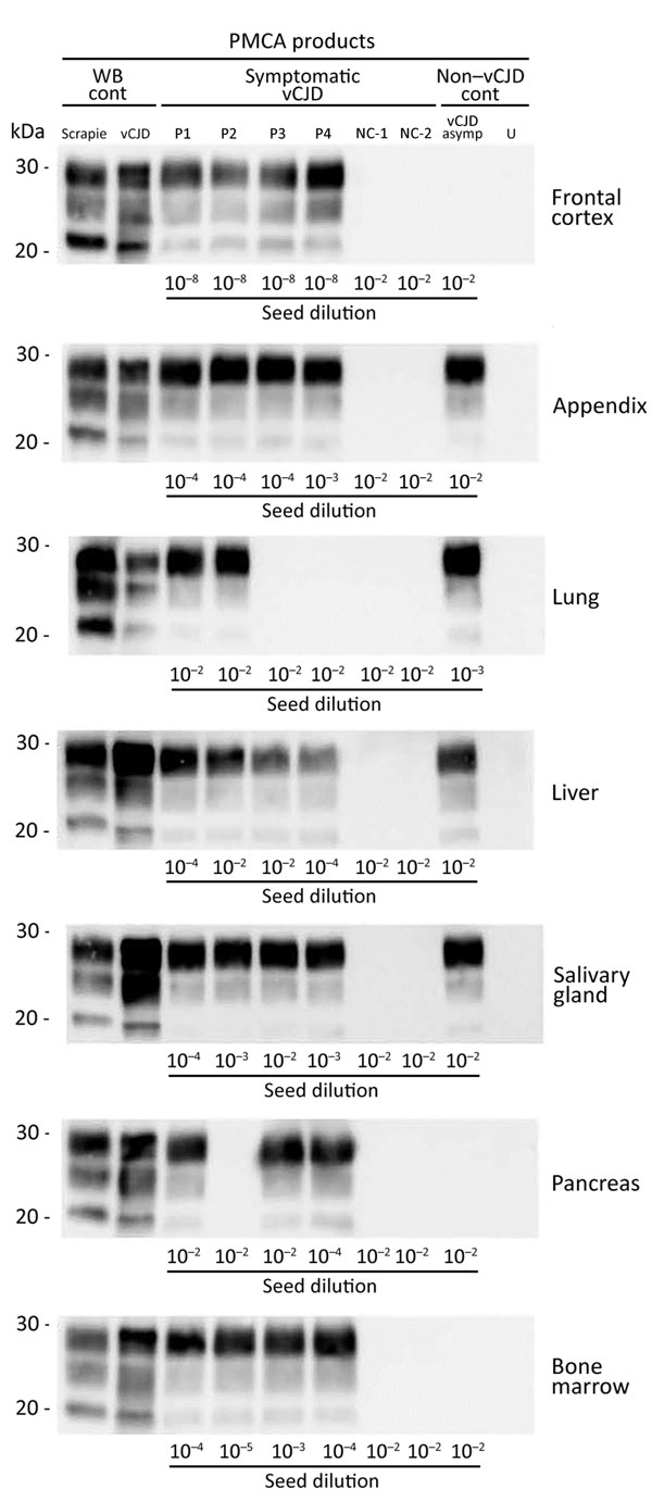 Western blots of proteinase K–resistant prions (PrPres) in PMCA reactions seeded with peripheral tissues. PMCA reactions were seeded with a 10-fold dilution series (10−2–10−9) of variant Creutzfeldt-Jakob disease (vCJD) tissue homogenates that had been collected postmortem from vCJD patients during the clinical stage (symptomatic vCJD patient 1–vCJD patient 4 [P1–P4]) or at an asymptomatic or preclinical stage of the disease (vCJD asymp) (Table 2). Reactions seeded with tissues from 2 non-vCJD p