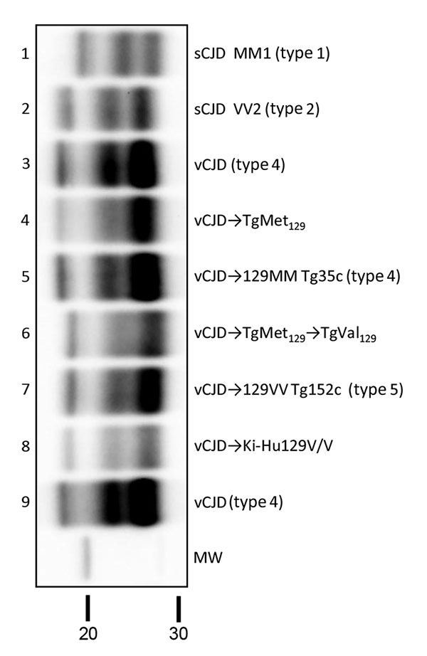 Biochemical comparison of brain protease-resistant prion protein (PrPres) detected in transgenic mice expressing prion protein Met129, and Val129 mice and inoculated with vCJD brain homogenate. Similar quantities of PrPres were loaded for adequate comparison, and immunoblots were detected by using Sha31 monoclonal antibody. Lanes 4 and 6 show passages from this study; lane 5 shows sample codification I-10629, and lane 7, sample codification I-11724 from the MRC Prion Unit in the United Kingdom (