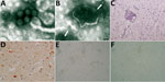 Thumbnail of Images of brain of fox with group A rotavirus infection and brains of suckling and weanling mice inoculated with fox brain homogenates. A, B) Negative-staining electron microscopy. Presence of virions morphologically related to family Reoviridae from fox (A) and mouse (B) brain (arrows). Scale bar in panel A indicates 200 nm; in panel B, 100 nm. C, D) Histologic and immunohistochemical appearance of the cerebral cortex of the fox. C) Perivascular cuffing of inflammatory cells in the