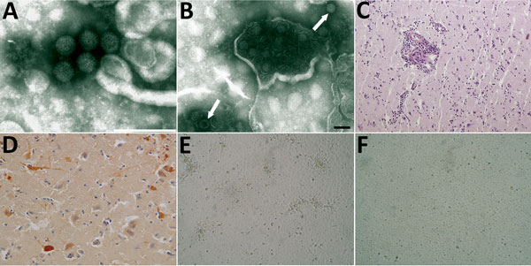 Images of brain of fox with group A rotavirus infection and brains of suckling and weanling mice inoculated with fox brain homogenates. A, B) Negative-staining electron microscopy. Presence of virions morphologically related to family Reoviridae from fox (A) and mouse (B) brain (arrows). Scale bar in panel A indicates 200 nm; in panel B, 100 nm. C, D) Histologic and immunohistochemical appearance of the cerebral cortex of the fox. C) Perivascular cuffing of inflammatory cells in the brain staine