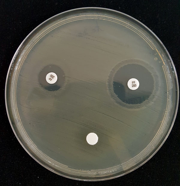 Inhibition of FosA-mediated fosfomycin resistance by phosphonoformiate. A modified Kirby-Bauer disk diffusion susceptibility assay was performed. In brief, a Mueller-Hinton agar plate was streaked with a 0.5 McFarland suspension of the isolate assayed. Three disks were placed on the agar: a 200-µg fosfomycin disk (upper left), a 100-µg phosphonoformiate disk (lower center), and a disk with both a 200-µg fosfomycin and 100-µg phosphonoformiate (upper right). The diameter of the growth inhibition 