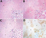 Thumbnail of Histopathologic and immunohistochemical findings in the livers of neotropical nonhuman primates that died of yellow fever, Espirito Santo, Brazil, January 2017. Asterisks (*) indicate centrilobular veins. A) Midzonal and centrilobular bridging hepatocellular lytic necrosis. Original magnification ×40; hematoxylin and eosin (H&amp;E) staining. Inset shows lytic hepatocellular necrosis with multiple Councilman-Rocha Lima (apoptotic) bodies (arrows). Original magnification ×400; H&amp;