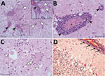 Thumbnail of Tissue sections of cervical spinal cord (A), brainstem (B, C) and cerebellum (D) stained with hematoxylin and eosin from a symptomatic newly weaned pig from a farm in Hungary show the signs of stage 3 encephalomyelitis. Mononuclear perivascular cuffs with vasculitis (black arrowheads), neuronal necrosis (white arrowheads), neurophagia (white double arrowheads), multifocal microgliosis, and signs of meningitis (black arrows) are shown. Scale bars indicate 50 µm (panels A, D) or 20 µm