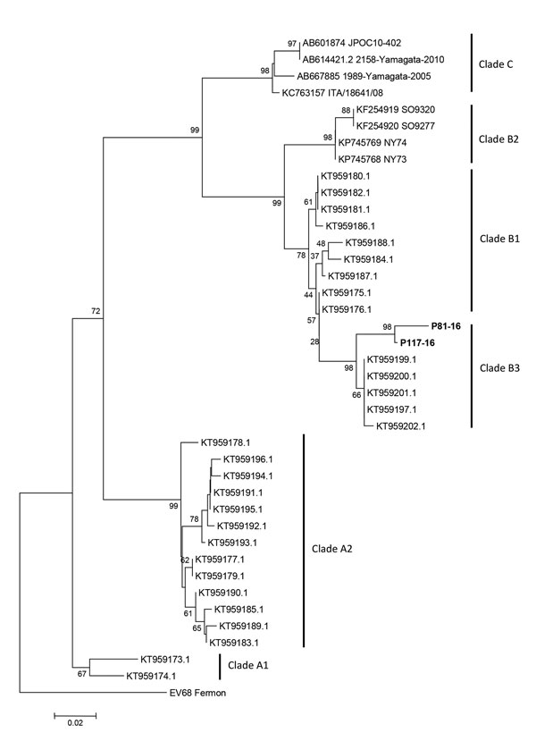 Molecular characterization of enterovirus D68 strains from Argentina, 2016, compared with reference strains from GenBank. Tree based on phylogenetic analyses of partial viral protein 1 genomic region (nucleotide positions 2554–2799, corresponding to the Fermon strain). Bold indicates strains detected in this study (GenBank accession nos. MF445419–20). We generated trees using the neighbor-joining method, as implemented in MEGA 6 software (http://www.megasoftware.net). Bootstrap values from 1,000