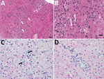 Thumbnail of Histopathologic findings in the livers of 2 adult horses experimentally infected with an equine biological product containing equine parvovirus-hepatitis (EqPV-H). A) Liver biopsy sample from horse 1 obtained 82 days after inoculation with EqPV-H. Numerous individual and small clusters of lymphocytes are scattered about the parenchyma (yellow arrows), indicative of lymphocytic lobular hepatitis. Hematoxylin and eosin (H&amp;E) stain. Scale bar = 200 μm. B) Higher magnification image