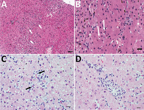 Histopathologic findings in the livers of 2 adult horses experimentally infected with an equine biological product containing equine parvovirus-hepatitis (EqPV-H). A) Liver biopsy sample from horse 1 obtained 82 days after inoculation with EqPV-H. Numerous individual and small clusters of lymphocytes are scattered about the parenchyma (yellow arrows), indicative of lymphocytic lobular hepatitis. Hematoxylin and eosin (H&amp;E) stain. Scale bar = 200 μm. B) Higher magnification image of the liver