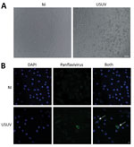 Thumbnail of Cerebrospinal fluid sample of a 39-year-old man in Montpellier, France, infected with USUV who had an atypical neurologic presentation. The sample was amplified for 6 days on C636 cells, and the supernatant was used to infect Vero cells or primary human astrocytes. A) Cytopathic effect (presence of adherent dead cells and absence of heaps; all dead cells were scattered) was observed at day 5 postinfection of a Vero cell culture. Scale bar indicates 100 μm. B) Mock or infected primar