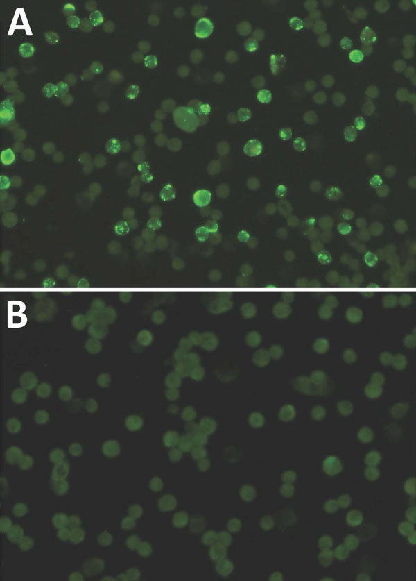 Immunofluorescence assay results of infected monkey serum A) characterized by granular staining pattern of HeLa cells and B) noninfected monkey serum. Original magnification ×400.