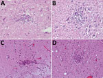 Thumbnail of Hematoxylin and eosin staining of typical typhus nodules in brain of typhus patients during World War II, Hamburg, Germany, 1940–1944. Most nodules were found in the pons and medulla oblongata. A) Loose nodule. B) Spongy nodule amid large neuronal cells. C) Compact typhus nodule along longitudinal blood vessel. Note hyperemia of other blood vessels nearby. D) Another compact nodule with hyperemic blood vessels nearby. Original magnifications ×40.