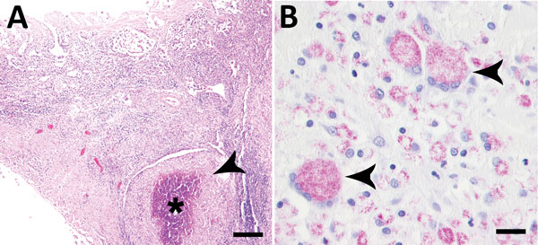 Results of histologic testing of samples from a domestic rabbit with Mycobacterium avium subsp. hominissuis infection, Germany A) Hematoxylin and eosin stain reveals multifocal severe granulomatous enteritis in the ileum with focally extensive necrosis (asterisk) and numerous surrounding macrophages (arrowhead). Scale bar indicates 300 µm. B) Ziehl-Neelsen stain shows numerous acid-fast bacilli in the cytoplasm of macrophages and multinucleated giant cells (arrowheads). Scale bar indicates 20 µm