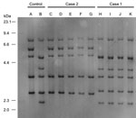 Thumbnail of Figure 2. Ribotyping tests for isolates from 2 case-patients with severe pneumonia caused by Corynebacterium ulcerans infection, Japan. Case-patient 1 isolate was categorized as R3 group and case-patient 2 isolate as R1 group. A, 0102 (R1 group); B, 0211 (R4 group); C, isolate from case-patient 2’s exudate on bronchus; D, isolate from cat 1’s throat in case 2; E, isolate from cat 2’s nasal cavity in case 2; F, isolate from cat 2’s throat in case 2; G, isolate from cat 2’s conjunctiv
