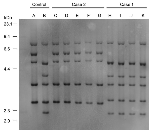 Figure 2. Ribotyping tests for isolates from 2 case-patients with severe pneumonia caused by Corynebacterium ulcerans infection, Japan. Case-patient 1 isolate was categorized as R3 group and case-patient 2 isolate as R1 group. A, 0102 (R1 group); B, 0211 (R4 group); C, isolate from case-patient 2’s exudate on bronchus; D, isolate from cat 1’s throat in case 2; E, isolate from cat 2’s nasal cavity in case 2; F, isolate from cat 2’s throat in case 2; G, isolate from cat 2’s conjunctiva in case 2; 