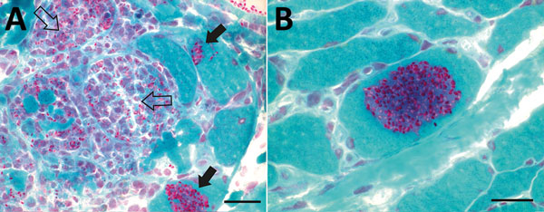 Light micrographs of Gomori trichrome–stained frozen sections of vastus lateralis muscle from a 66-year-old man with Anncaliia algerae microsporidial myositis, New South Wales, Australia. A) Necrotising myositis with red-stained, ovoid spores in green-staining viable myocytes (solid arrows) and within macrophages invading necrotic myocytes (open arrows). B) A cluster of red stained, 2–3 µm spores within a viable myocyte. Scale bars = 25 µm.