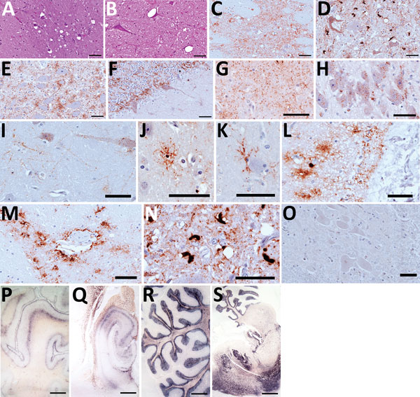 Hematoxylin and eosin staining (A, B), immunohistochemistry (C–O), and paraffin-embedded tissue blot analysis (P–S) of brains of dromedary camels brought for slaughter to the Ouargla abattoir, Algeria, 2015–2016. Spongiform change of neuropil, gliosis, and neuronal loss in thalamus (A) and intraneuronal vacuolation in pons (B) (scale bar = 50 μm). Immunohistochemistry for prion protein (PrPSc) with L42 monoclonal antibody evidenced dense synaptic/punctate deposition in thalamus (C) and intraneur