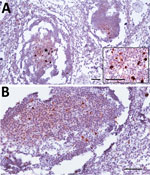Thumbnail of Prion protein immunolabelling in the germinal center of lymphoid follicles of cervical (A) and prescapular (B) lymph nodes of dromedary camel no. 8, Ouargla abattoir, Algeria. The architecture of lymph nodes appears moderately compromised by the partial freezing of samples accidentally occurred before fixation. Scale bars = 50 μm. Inset in panel A: higher magnification showing the germinal center marked with asterisk; scale bar = 25 mm.
