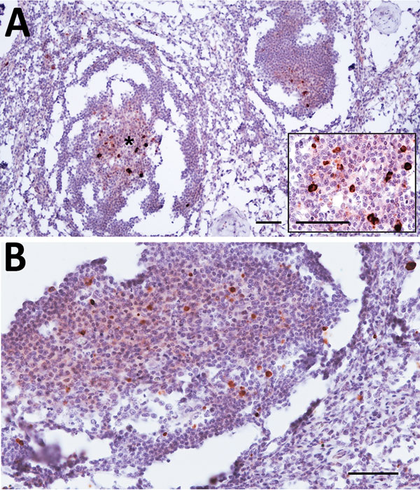 Prion protein immunolabelling in the germinal center of lymphoid follicles of cervical (A) and prescapular (B) lymph nodes of dromedary camel no. 8, Ouargla abattoir, Algeria. The architecture of lymph nodes appears moderately compromised by the partial freezing of samples accidentally occurred before fixation. Scale bars = 50 μm. Inset in panel A: higher magnification showing the germinal center marked with asterisk; scale bar = 25 mm.