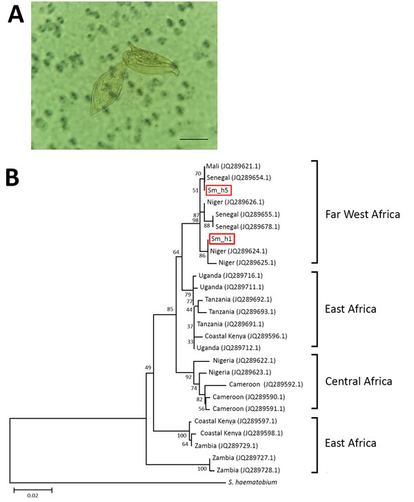 Characterization of Schistosoma parasites detected in 14-year-old migrant boy from Côte d’Ivoire in France, 2017. A) Co-detection of terminal-spined schistosome eggs (typical of Schistosoma haematobium parasites) and lateral-spined schistosome eggs (typical of Schistosoma mansoni parasites) in urine sample from migrant boy. Sample was microscopically examined after filtration. Original magnification ×400. Scale bar represents 50 µm. B) Phylogenetic analysis of S. mansoni cox1 gene haplotypes pre