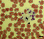 Thumbnail of Giemsa-stained peripheral blood smear of a 34-year-old woman with tickborne relapsing fever, Austin, Texas, USA, showing 2 spirochetes (arrows). Scale bar indicates 20 μm.