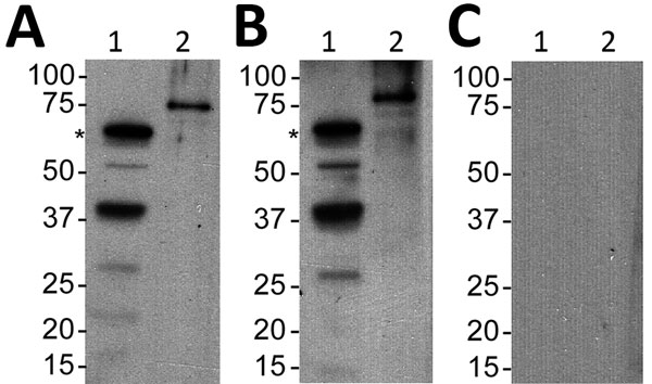 Serologic responses to Borrelia turicatae protein lysates and rBipA in 34-year-old woman with tickborne relapsing fever, by detected by immunoblotting, Austin, Texas, USA. A) Serum sample from the case-patient; B) positive control serum sample from another case-patient; C) negative control sample. Lane 1, B. turicatae; lane 2, rBipA. Values on the left are in kilobases. Asterisks (*)  indicate the size of native BipA. rBipA, recombinant Borrelia immunogenic protein A.
