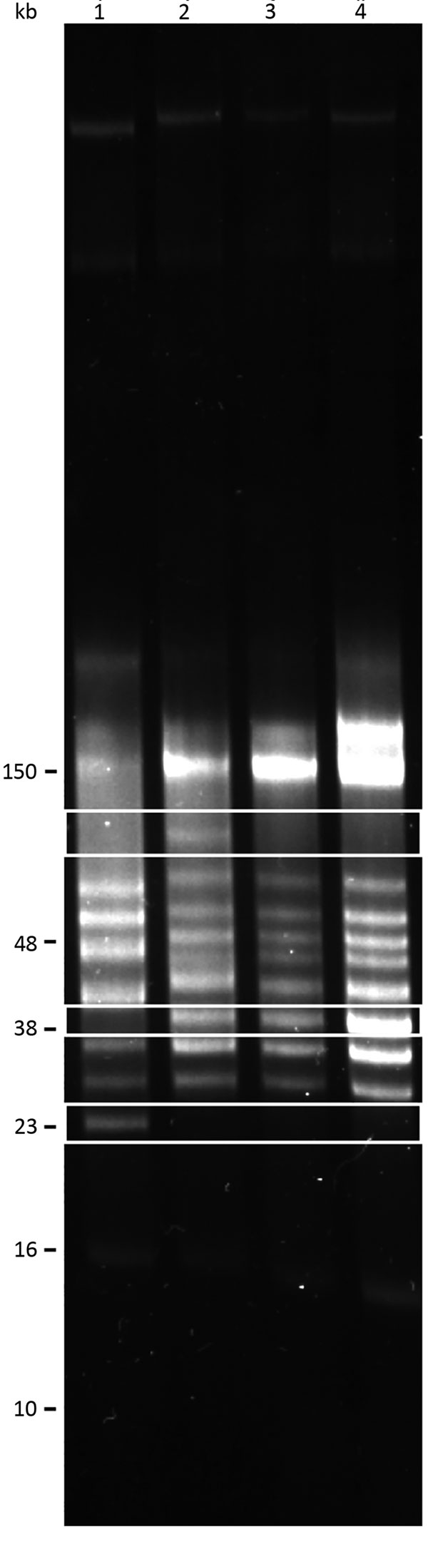 Reversed-field gel electrophoresis of Borrelia turicatae isolates collected from Ornithodors turicata ticks, Austin, Texas, USA (BRP1, BRP1a, and BRP2) and an isolate from previously field-collected ticks (91E135) (9). Lane 1, 91E135; lane 2, BRP1; lane 3, BRP1a; lane 4, BRP2. White boxes indicate a plasmid in BRP1 that is absent from the other strains (top); plasmids unique to BRP1, BRP1a, and BRP2 (middle); and a plasmid in 91E135 strain that is absent in isolates from Austin (bottom).