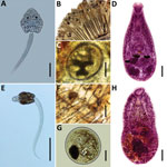 Thumbnail of Species of heterophyids transmitted by Melanoides tuberculata snails in Peru. A–D) Centrocestus formosanus: cercaria (pleurolophocercous type) (A), encysted metacercariae in gills of Poecilia reticulata (B, C), and adult parasite obtained in experimentally infected mouse (D). E–H) Haplorchis pumilio: cercaria (parapleurolophocercous type) (E), metacercariae found at the base of the caudal fin of P. reticulata (F–G), and adult recovered in experimentally infected mouse (H). Scale bar