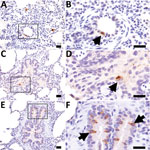 Thumbnail of Influenza D virus immunohistochemistry in swine lung at 3 days (A and B), 5 days (C and D), and 7 days (E and F) postinoculation. Right column panels are higher magnification of boxed region in panels to the left. At all time points, scattered immunopositive bronchiolar epithelial cells were observed (arrows). Scale bars indicate 20 µm.