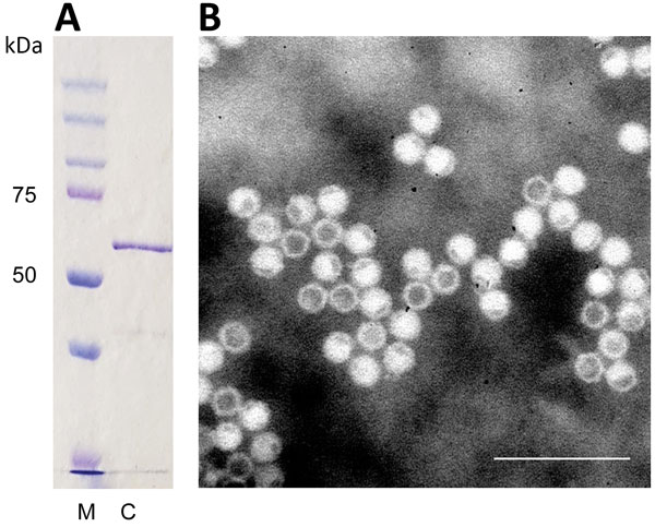 A) Identification of cutavirus from human serum samples. A) Sodium dodecyl sulfate–polyacrylamide gel electrophoresis of virus capsid protein 2. Lane M, protein size marker; lane C, cutavirus. B) Electron micrograph of cutavirus virus-like particles. Scale bar indicates 100 nm.