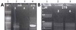 Thumbnail of A) Results of K26 PCR assay (13) on patient samples identified as belonging to the Leishmania infantum/donovani complex in study of leishmaniasis control programs in northern Syria. Lane 1, step marker; lanes 2 and 3, L. infantum strain 268 with 3 and 6 μL of DNA, respectively; lane 4, L. donovani strain 275 with 3 μL of DNA. B) Results of K26 PCR assay (13) on patient samples identified as belonging to the Leishmania infantum/donovani complex in study of leishmaniasis control progr