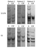 Thumbnail of Single-strand conformation polymorphism analysis of 5′ UTR and E2 region human pegivirus amplicons from 3 patients with encephalitis of unclear origin, Poland, 2012–2015. CSF, cerebrospinal fluid; S, serum; UTR, untranslated region.