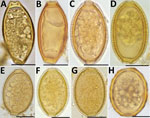 Thumbnail of Helminth eggs found in stool samples from persons in Lofa County, Liberia. A, B) Eggs of Trichuris trichiura in samples positive for T. trichiura by Kato-Katz smear and by qPCR. C–F) Eggs of Capillaria spp. in samples positive for T. trichiura by Kato-Katz smear but negative for T. trichiura by qPCR. G) Egg of Capillaria spp. in sample positive for Ascari lumbricoides by Kato-Katz smear but negative for A. lumbricoides by qPCR. H) Egg of A. lumbricoides in sample positive for A. lum