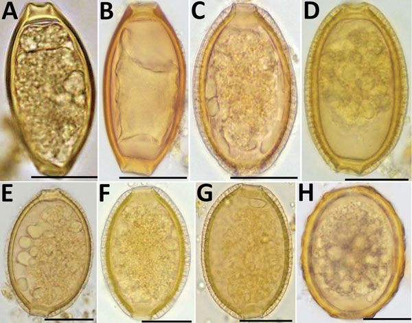 Helminth eggs found in stool samples from persons in Lofa County, Liberia. A, B) Eggs of Trichuris trichiura in samples positive for T. trichiura by Kato-Katz smear and by qPCR. C–F) Eggs of Capillaria spp. in samples positive for T. trichiura by Kato-Katz smear but negative for T. trichiura by qPCR. G) Egg of Capillaria spp. in sample positive for Ascari lumbricoides by Kato-Katz smear but negative for A. lumbricoides by qPCR. H) Egg of A. lumbricoides in sample positive for A. lumbricoides by 
