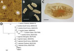 Thumbnail of Human taeniasis caused by Taenia saginata tapeworms in 2 brothers 8 and 10 years of age, Yangon, Myanmar, 2017. A) Eggs of T. saginata from younger brother found in a Kato-Katz fecal smear. B) Proglottids from younger brother expelled after treatment with praziquantel (10 mg/kg in a single dose). C) A gravid proglottid showing &gt;13 main lateral branches compactly. D) Phylogenetic relationships between the nucleotide sequences obtained from the 2 children (boldface; GenBank accessi
