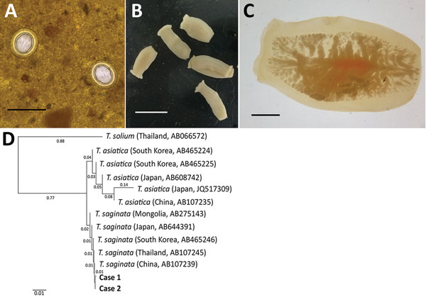 Human taeniasis caused by Taenia saginata tapeworms in 2 brothers 8 and 10 years of age, Yangon, Myanmar, 2017. A) Eggs of T. saginata from younger brother found in a Kato-Katz fecal smear. B) Proglottids from younger brother expelled after treatment with praziquantel (10 mg/kg in a single dose). C) A gravid proglottid showing &gt;13 main lateral branches compactly. D) Phylogenetic relationships between the nucleotide sequences obtained from the 2 children (boldface; GenBank accession no. MH0706