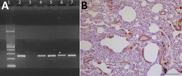 Evidence of dolphin morbillivirus infection in Eurasian otters (Lutra lutra), southwestern Italy. A) Comparison of nucleoprotein gene amplification products from infected otters, obtained by reverse transcription PCR. A specific band at the expected molecular weight of 287 bp is shown. Lane 1, molecular weight marker (Tracklt 100bp DNA Ladder; Invitrogen, http://www.thermofisher.com); lane 2, positive control (lung tissue from an infected striped dolphin, Stenella coeruleoalba); lane 3, negative
