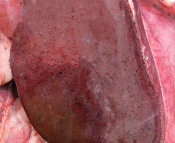 Gross pathologic view of liver of white-tailed deer no. 44, after experimental infection with Rift Valley fever virus inoculum. The animal died at ay day 3 postinoculation; at necropsy, the liver showed severe, multifocal, hemorrhagic hepatic necrosis attributed to acute infection with Rift Valley Fever virus.