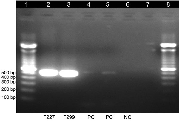 Gel electrophoresis of dengue virus–specific RT-PCR products in study of dengue virus among 166 children with suspected malaria, Accra, Ghana, October 2016–July 2017. We completed a conventional RT-PCR assay by using dengue-specific primers from Lanciotti et al. (15) to confirm the results of the TaqMan array card assays. The amplification products (expected size 511 bp) were electrophoresed on 2% agarose gel, stained with ethidium bromide, and viewed under ultraviolet light. Lane 1, molecular w