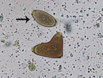 Thumbnail of Conjoined Trichuris vulpis eggs from a domestic dog, visualized on fecal flotation. Arrow indicates a morphologically normal egg. Original magnification ×400. Photograph by Danielle E. Preston and courtesy of Mani Lejeune, both of the Cornell University College of Veterinary Medicine (Ithaca, NY, USA). 