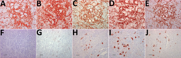 Immunohistochemical detection of disease-associated prion protein in brain sections at the level of the obex in cervids with chronic wasting disease, Norway. A–E) Reindeer; F–J) moose. mAbs used were 12B2 (A, F), 9A2 (B, G), L42 (C, H), SAF 84 (D, I), and F99/97.6 (E, J). Staining obtained in the reindeer tissues are similar regardless of mAbs used (A–E). Conversely, for moose tissues, the staining was primarily observed intraneuronally with L42, SAF84, and F99/97.6 (H–J) but was not observed us