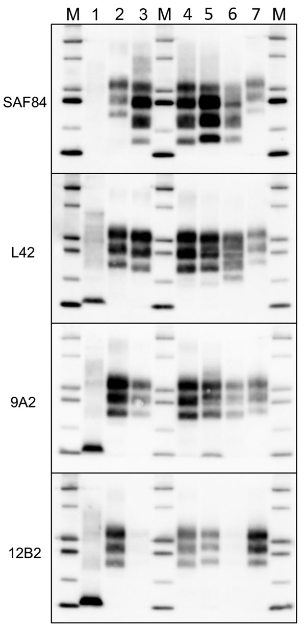 Comparison of protease-resistant PrPres from moose (Alces alces) with chronic wasting disease and from sheep with scrapie, Europe. Representative blots show epitope mapping analysis ofPrPres (lane 4, CH1641; lane 5, moose no. 1; lane 6, moose no. 2) in comparison with different ovine transmissible spongiform encephalopathy isolates (lane 1, atypical/Nor98; lane 2, classical scrapie; and lane 3, CH1641). A chronic wasting disease isolate from Canada was loaded as control (lane 7). The antibodies 
