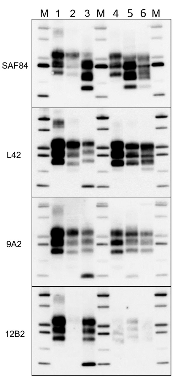 Comparison of protease-resistant core of abnormal form of prion protein from moose (Alces alces) in Europe with chronic wasting disease and from cattle with BSE. Representative blots show epitope mapping analysis of protease-resistant core of abnormal form of prion protein in moose (lane 5, moose no. 1; lane 6, moose no. 2) in comparison with different BSE isolates (lane 2, classical BSE; lane 3, H-type BSE; and lane 4, L-type BSE). A sheep scrapie isolate was loaded as control (lane 1). The ant